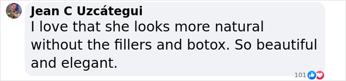 66YO Madonna Brings Back Natural Look At Met Gala 2025 After Concerning Plump Cheeks And Pout