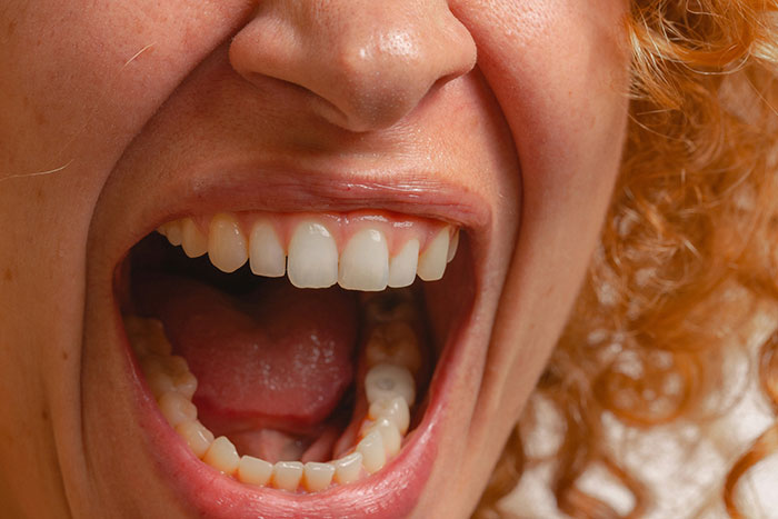 Close-up of a person with curly hair opening mouth wide, expressing intense emotion related to narcissists and sociopath siblings.