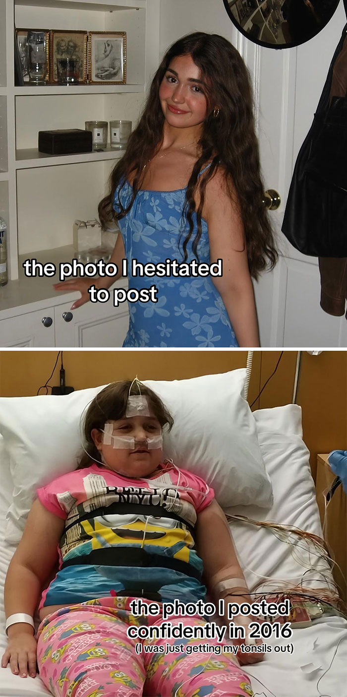 Side-by-side pics showing the photo hesitated to post versus the photo confidently posted with tonsil removal context.