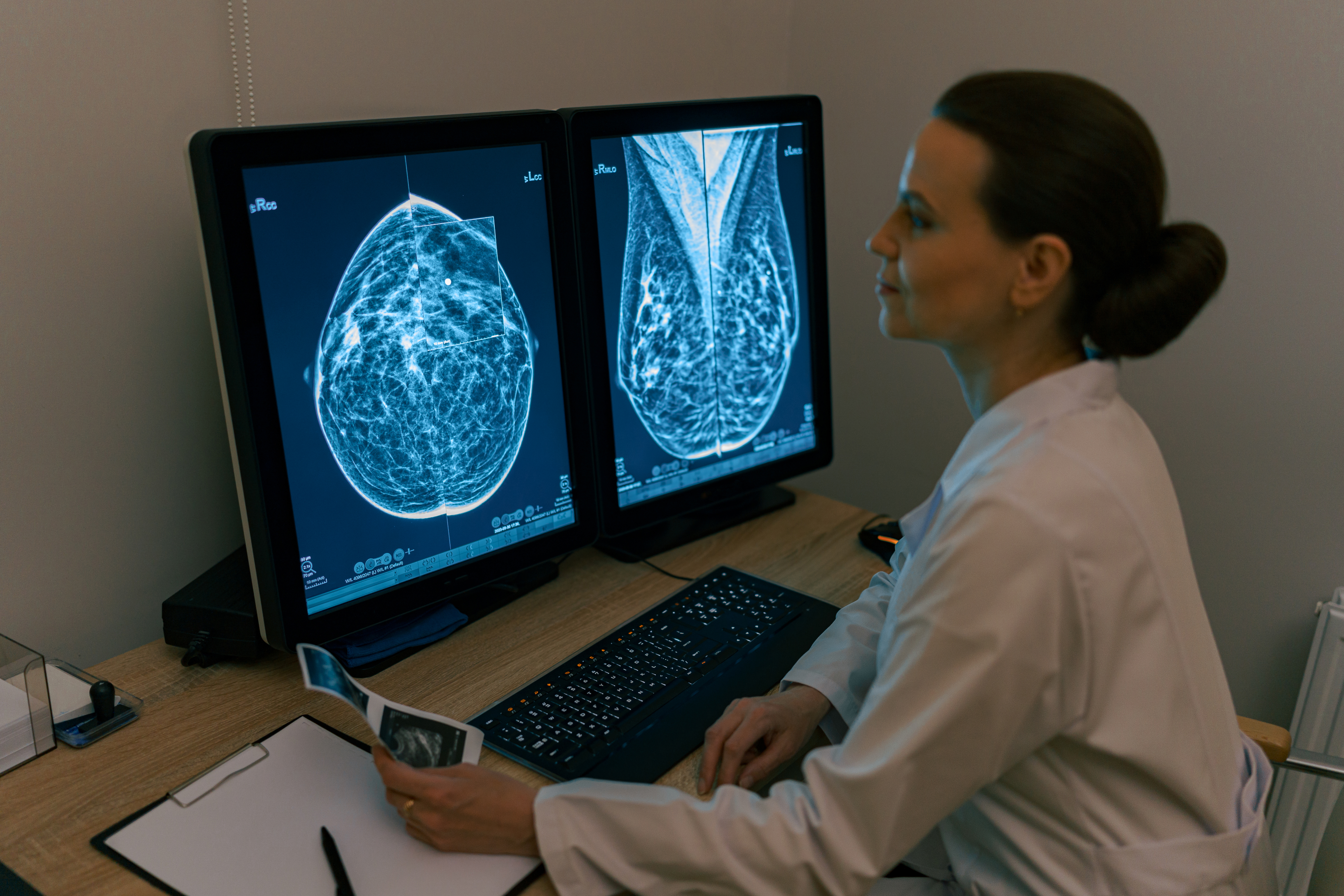 Doctor examining breast cancer scans on computer monitors, highlighting heartbreaking cancer diagnosis and pregnancy assumptions.