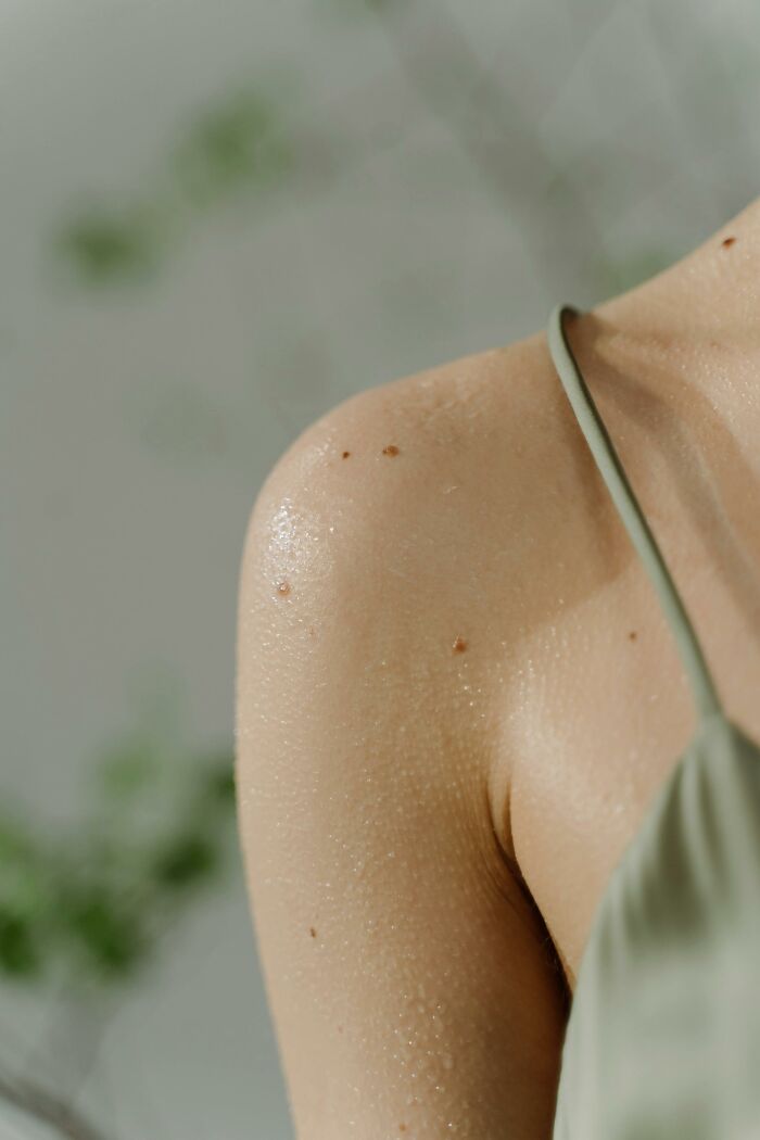 Close-up of a shoulder with smooth skin and natural moles, illustrating people who won the genetic lottery.