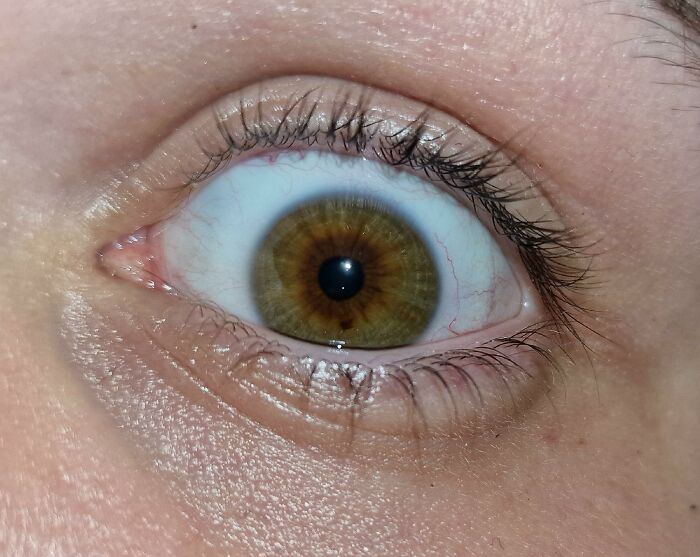 Close-up of an eye showing detailed iris pattern, illustrating unique traits linked to winning the genetic lottery.