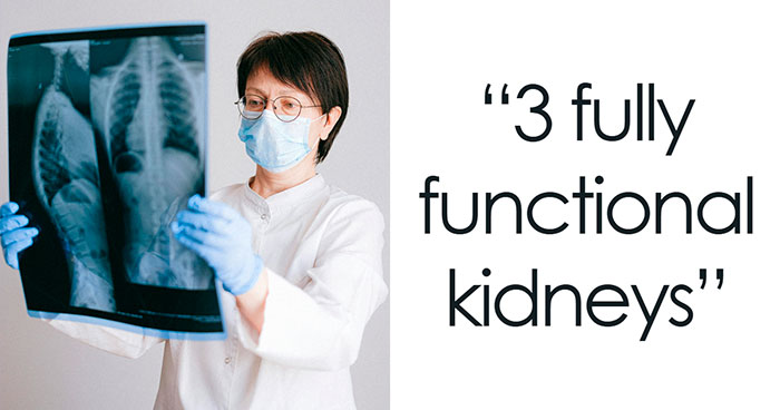 “Haven’t Had To Shave In 26 Years”: 40 People Who Absolutely Won The Genetic Lottery