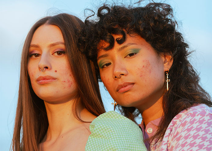 Two confident women with natural skin, showcasing things women stopped pretending they like after 30 in a casual outdoor setting.