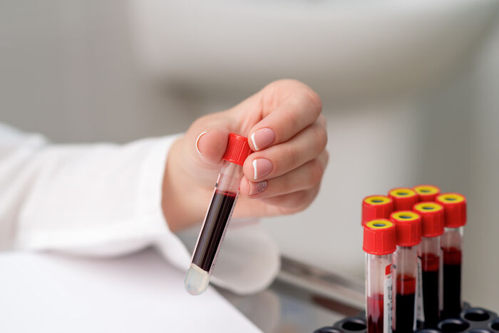 Hand holding a blood sample vial among multiple vials, illustrating one of the weirdest ways people earned quick money.