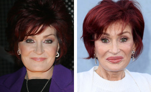 “Absolutely Disgusting”: ‘Ozempic Mouth’ Is Latest Bizarre Side Effect Of Weight-Loss Substance