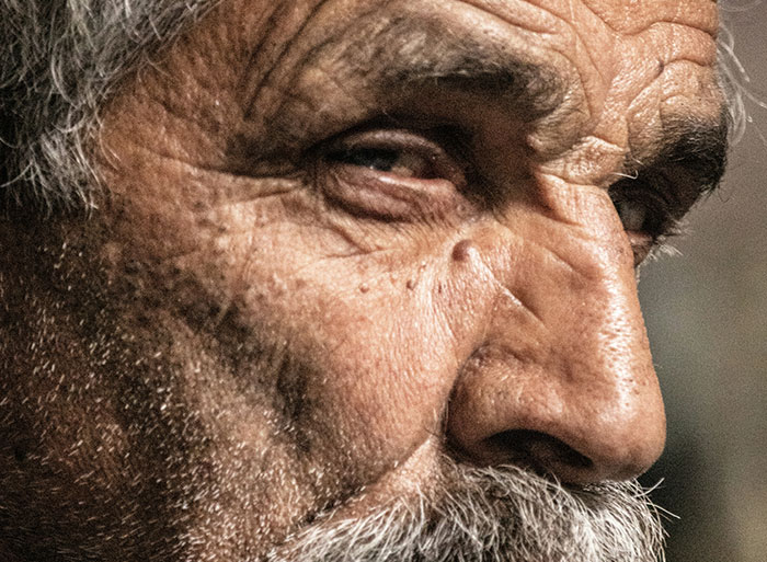 Close-up of an elderly man's face with detailed wrinkles, illustrating healthcare workers' medical analogies.