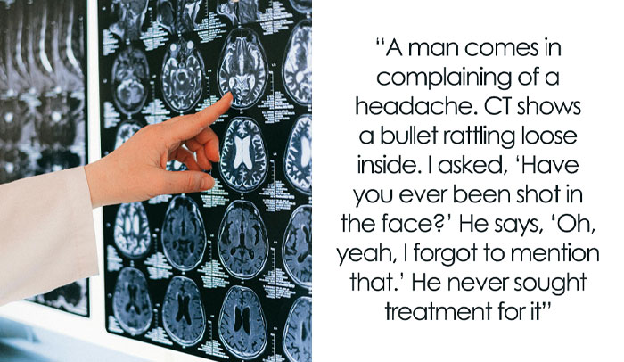 “Don’t Google It”: 40 Of The Weirdest And Most Unusual Things Seen In Human Bodies