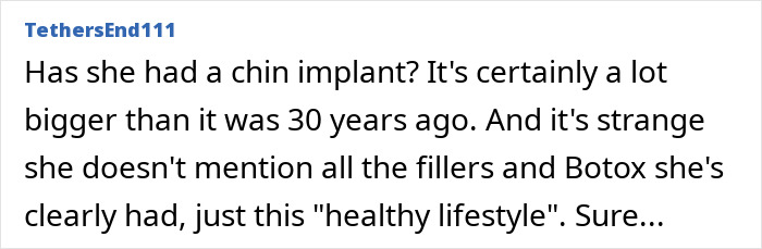 Comment discussing speculation about Whigfield's chin implant and cosmetic procedures despite claims of a healthy lifestyle.