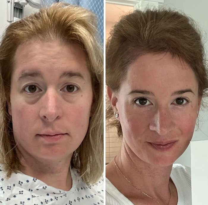 Side-by-side comparison of a woman showing small appearance changes that made a significant difference for her.