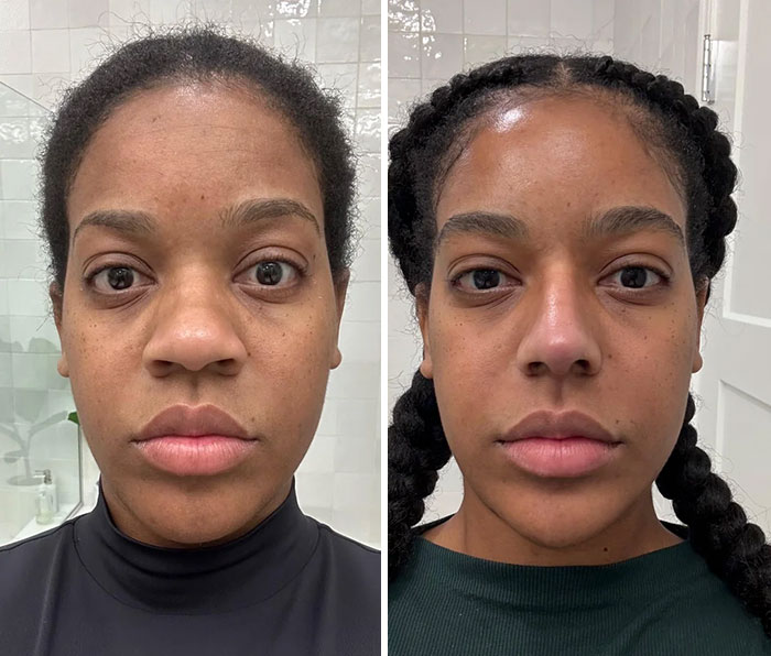 Before and after photos of a woman showing small appearance changes that made a big difference for skin and hair.