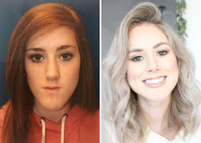 Before and after photos of a woman showing small appearance changes that made a big difference for women’s confidence.