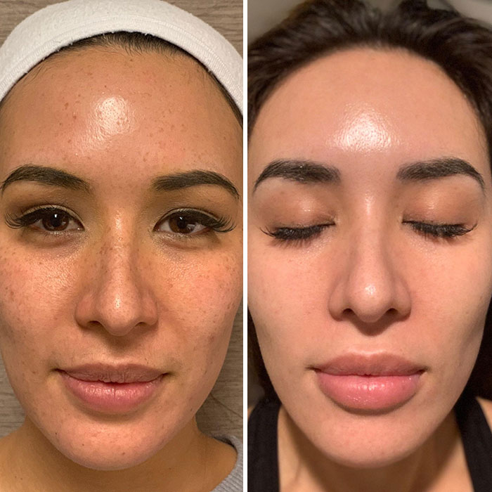 Before and after photos showing women’s small appearance changes that made a big difference in their skin texture and tone.