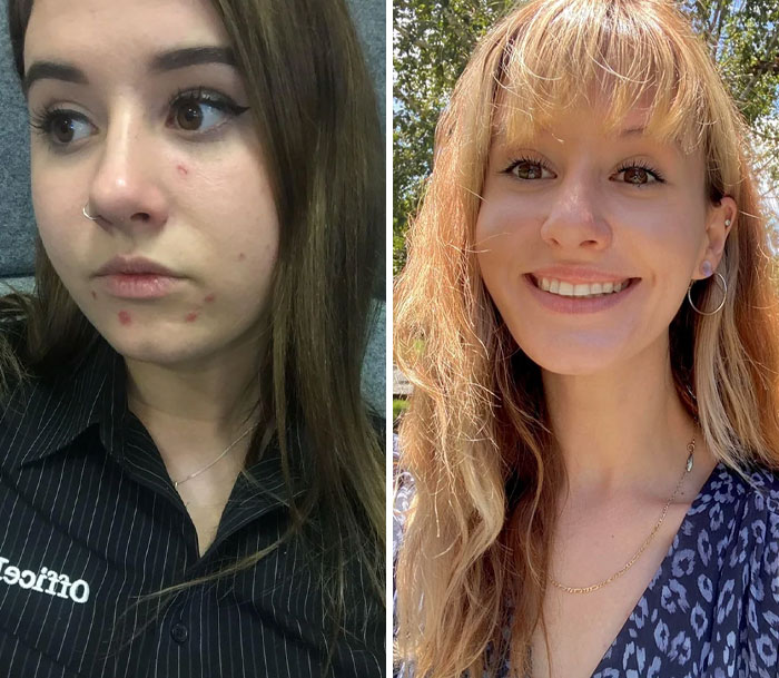 Before and after images showing small appearance changes made by women that created a big difference in their look and confidence.