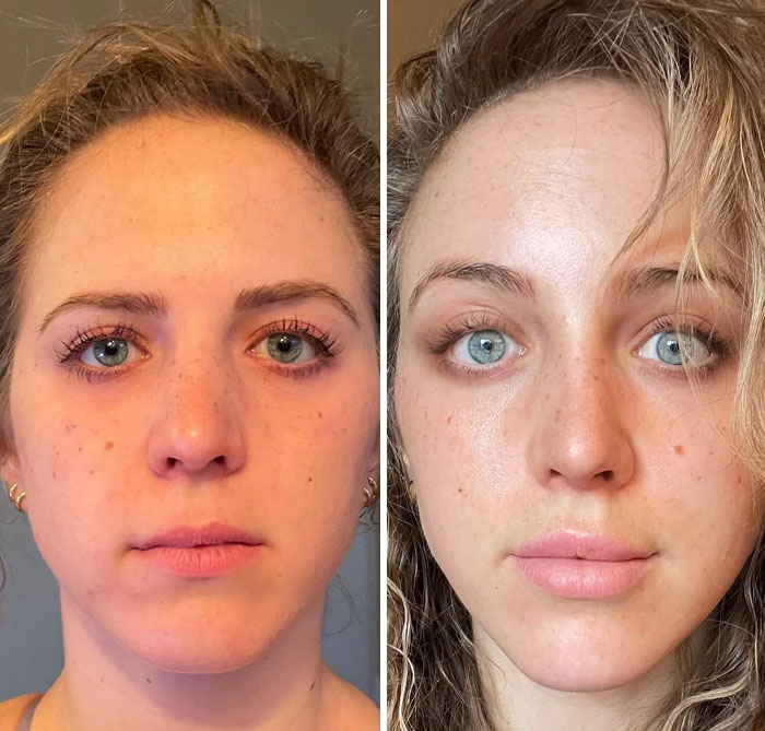 Side-by-side comparison of a woman showing small appearance changes that made the biggest difference for her face.