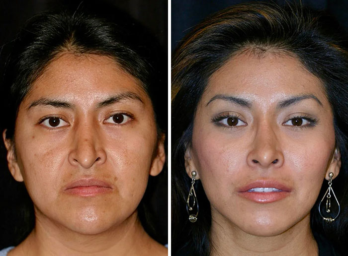 Before and after images of a woman showing small appearance changes that made the biggest difference for women.