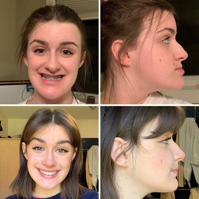 Before and after photos of women showing small appearance changes that made the biggest difference for them.