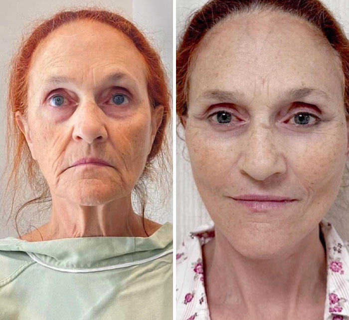 Before and after comparison of a woman showing small appearance changes that made a big difference in her look.