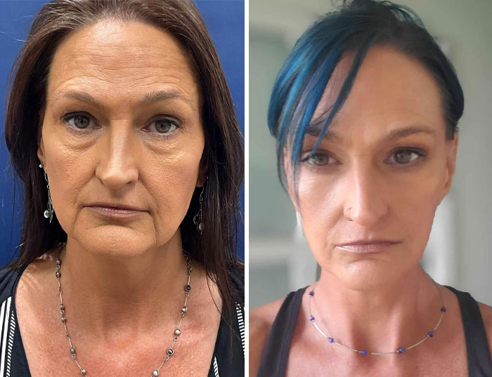 Before and after photos of a woman showing small appearance changes that made a big difference for women’s confidence.