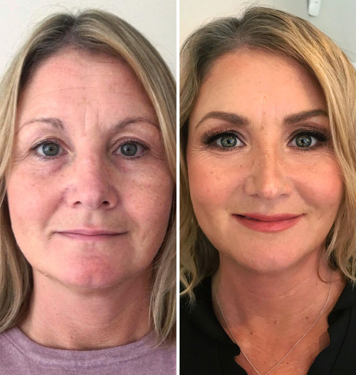 Before and after image showing small appearance changes enhancing a woman's look and confidence for noticeable difference.