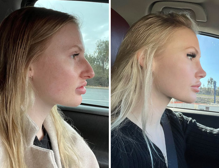 Side-by-side photos of a woman showing small appearance changes that made a big difference in her look.