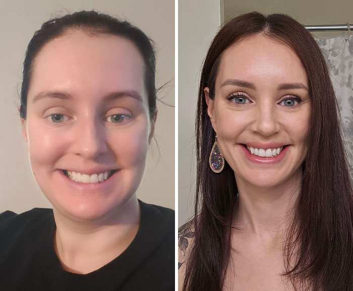 Before and after photos of a woman showing small appearance changes that made a big difference for women’s confidence.