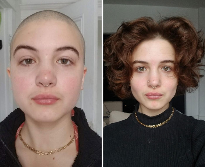 Side-by-side photos showing a woman before and after a small appearance change with hair growing back, highlighting appearance changes.