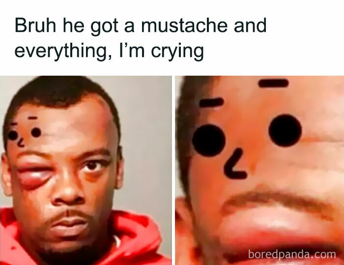Man with swollen eye and added cartoon face features, a relatable meme for humor and laughs in meme culture.