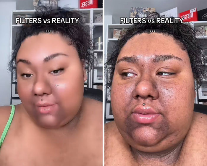 Woman showing clear difference between filters vs reality on her face in a side-by-side comparison photo.