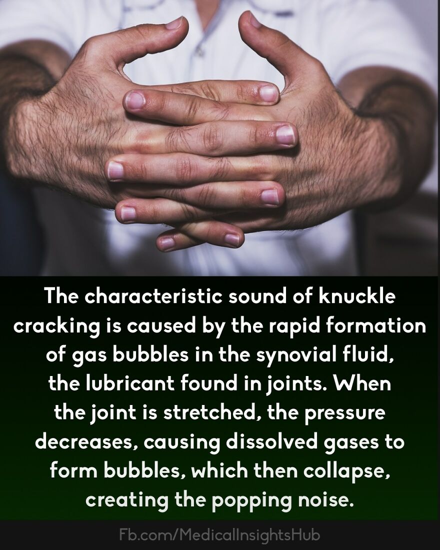 Close-up of hands cracking knuckles explaining the medical fact that fingers contain no muscles in the joints.