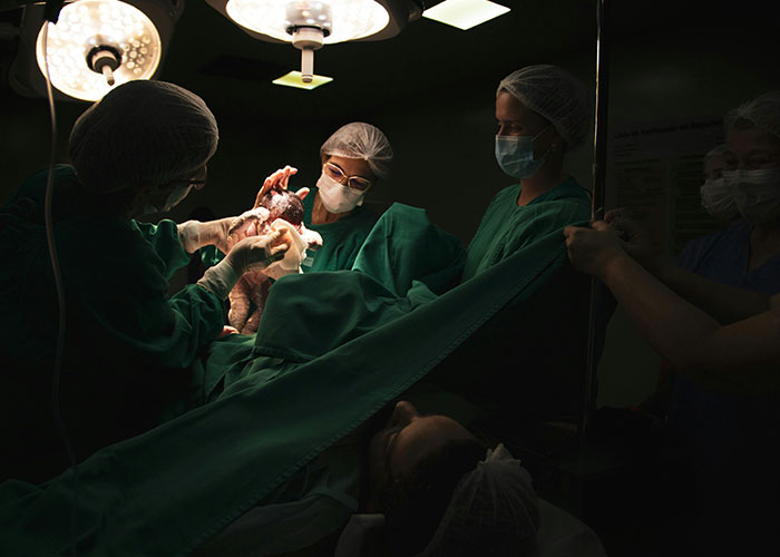 Medical team delivering a newborn during a cesarean section, showing the real experience inside the birthing room.
