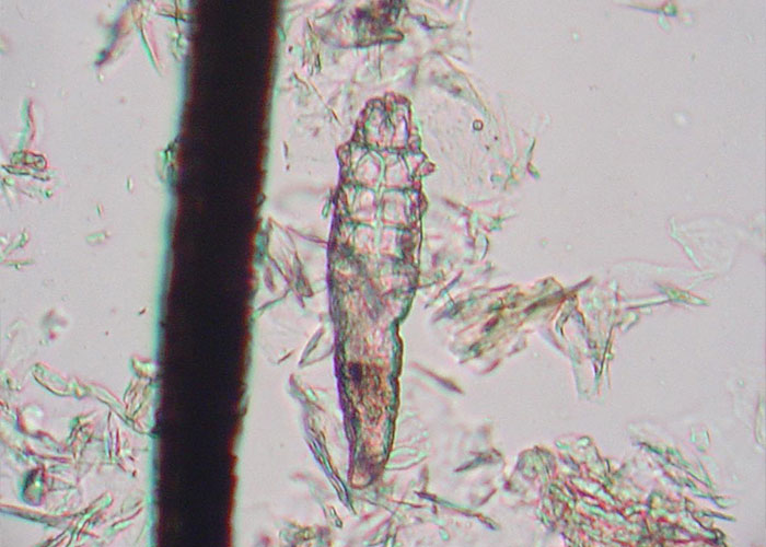 Close-up microscopic image of a creepy fact showing a tiny parasite near a human hair strand.