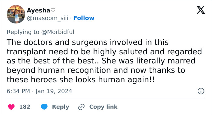 Tweet praising doctors and surgeons for a successful face transplant on a woman torn apart by a chimpanzee, restoring her appearance.