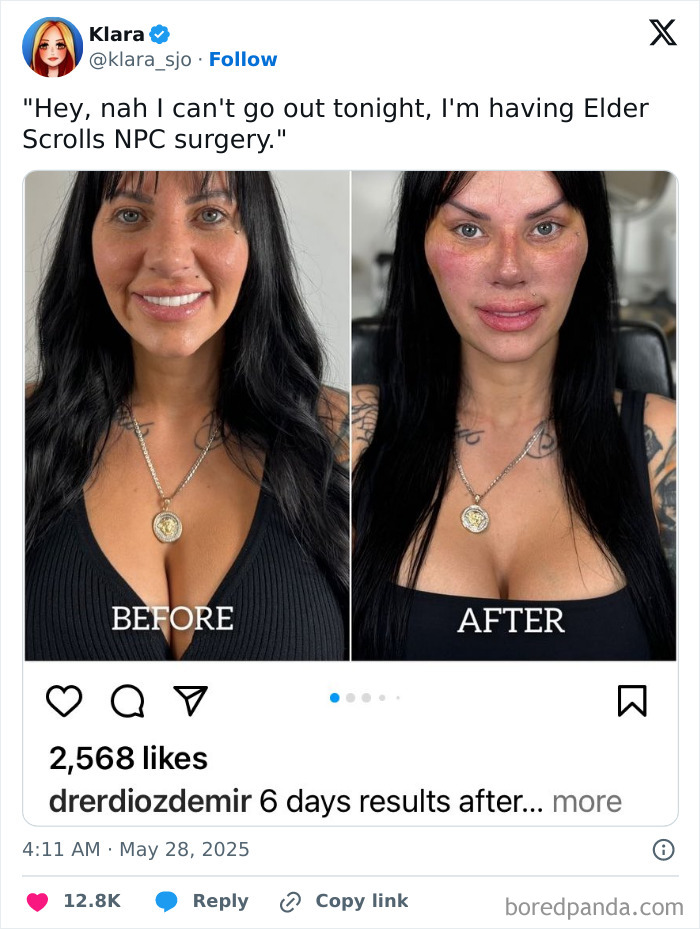 Side-by-side before and after photos showing a woman’s face after NPC surgery, sparking hmmm moments.