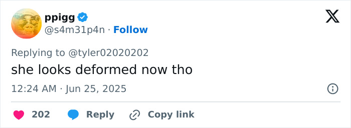 User's tweet text reading she looks deformed now tho on a white social media interface, discussing woman's facelift reaction online.