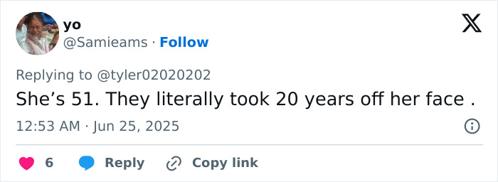 Tweet screenshot showing a user commenting on a woman&rsquo;s facelift, saying it took 20 years off her face.