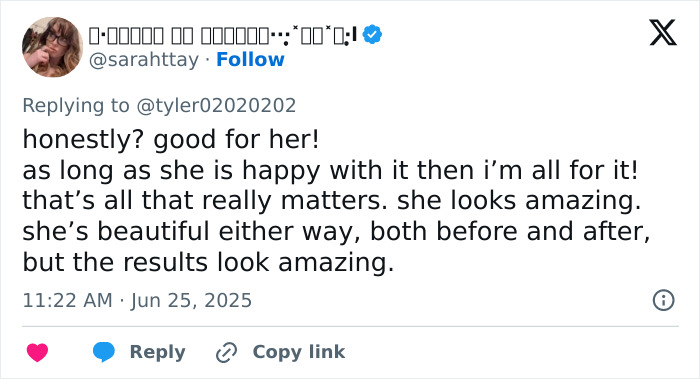 Tweet praising a woman&rsquo;s facelift results, highlighting her beauty before and after and expressing support for her happiness.