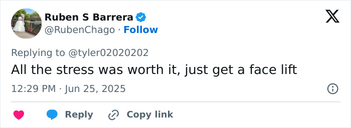 Tweet by Ruben S Barrera encouraging a woman's facelift, stating all the stress was worth it for the facial transformation.