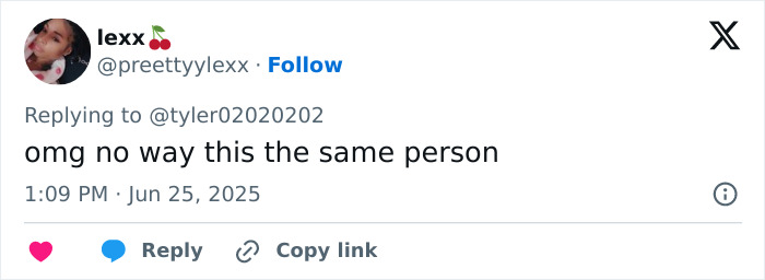 Woman's facelift reaction on social media as people express shock over her before and after appearance.