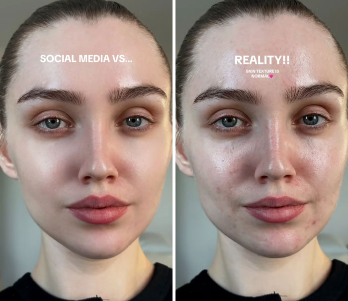 Side-by-side comparison of a woman’s filtered social media appearance versus her natural skin without filters.
