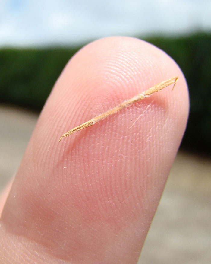 Tiny splinter stuck in finger close-up, illustrating a common issue addressed in surprisingly effective old wives' tales.