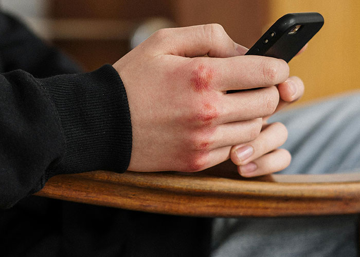 Close-up of hands with red marks holding a smartphone, illustrating a take one for the team moment in everyday life.