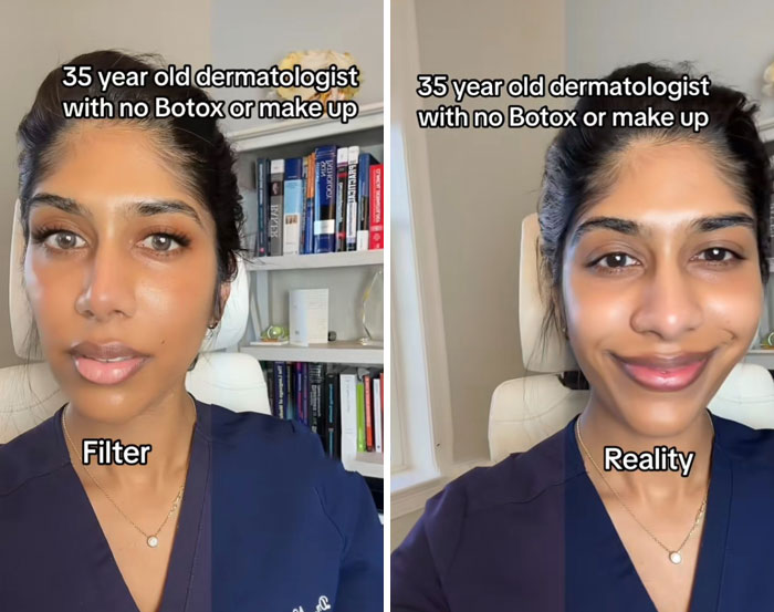 35-year-old woman dermatologist shows difference between filtered and unfiltered appearance highlighting women filters vs reality.