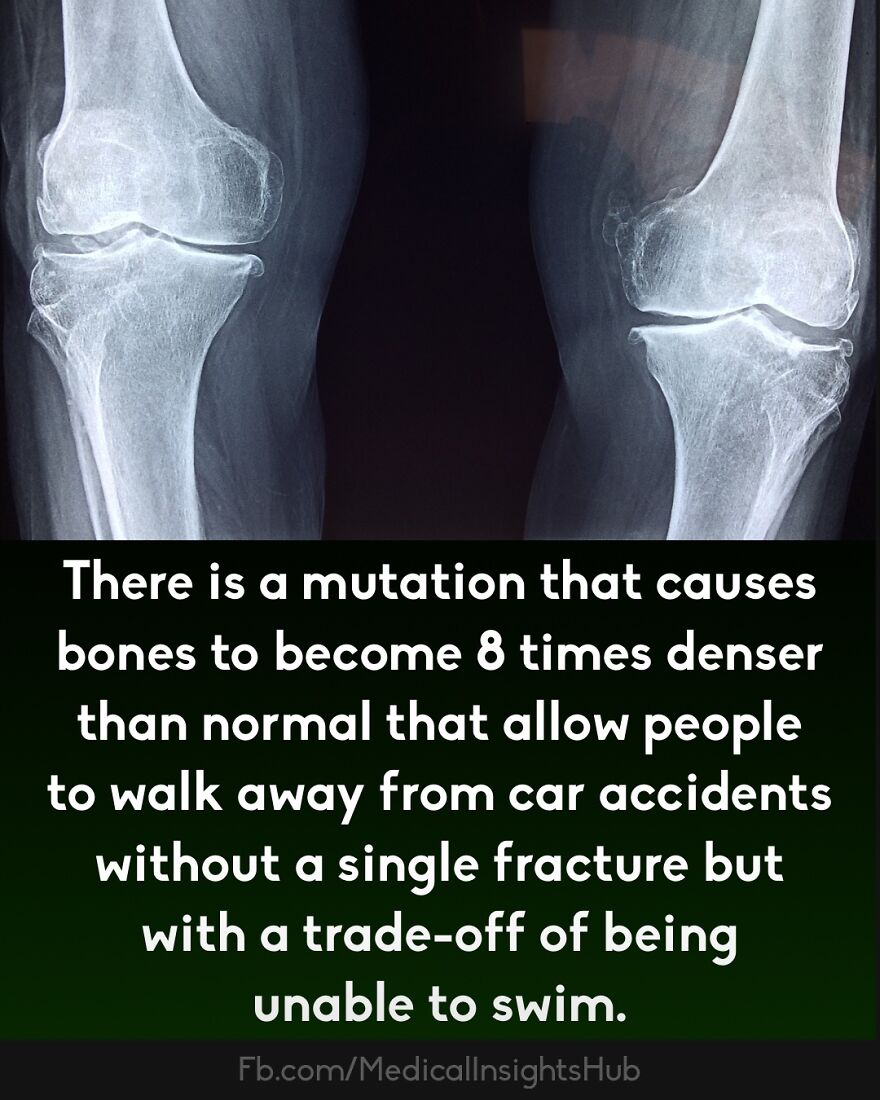 X-ray image of knee bones shown with fact about bones denser mutation, related to fingers contain no muscles medical facts.
