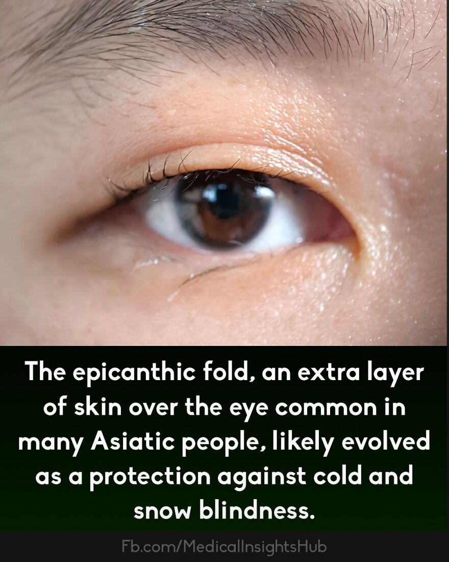 Close-up of an eye showing the epicanthic fold, illustrating a curious medical fact about human anatomy and evolution.