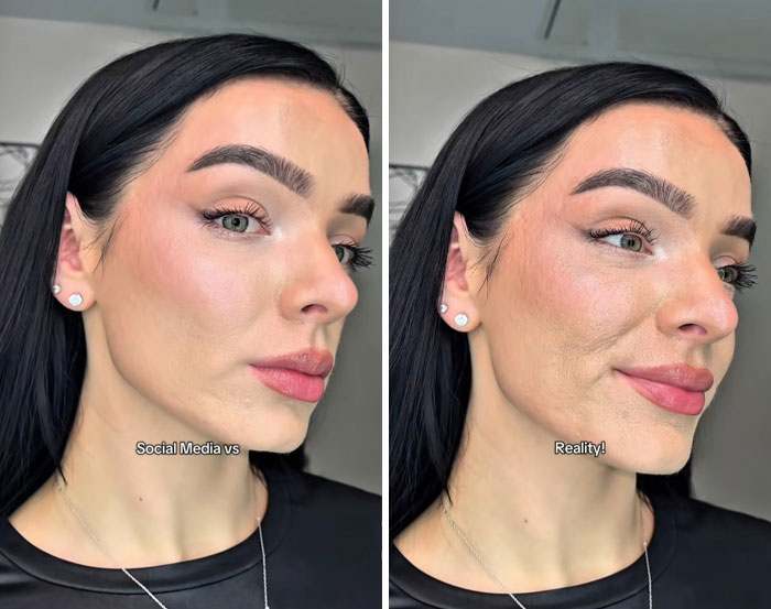 Woman showing difference between filtered and unfiltered face, illustrating women look with filters vs without filters.