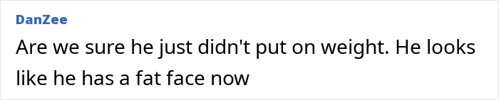 Comment discussing possible weight gain affecting Kevin Spacey's face amid plastic surgery rumors after his red carpet appearance.