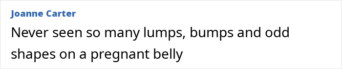 Comment highlighting unusual lumps and bumps on a pregnant belly in Meghan Markle&rsquo;s twerking pregnancy video fueling conspiracy theories.