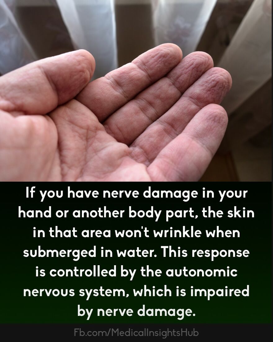 Close-up of a hand showing skin texture with a fact about nerve damage and finger muscles explained by medical insights.