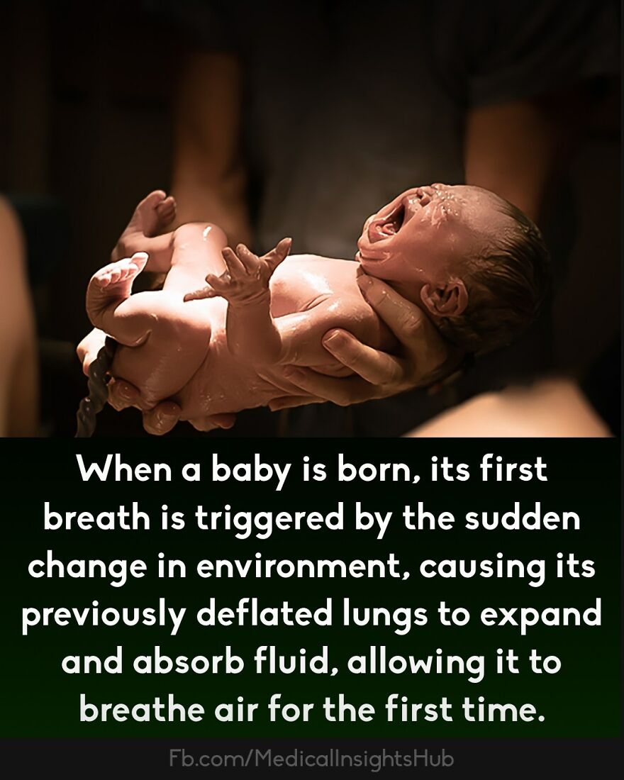 Newborn baby crying just after birth, highlighting curious medical facts about fingers containing no muscles.